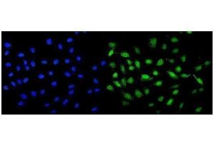 IF analysis of MCAK using anti-MCAK antibody (ABIN3043278).