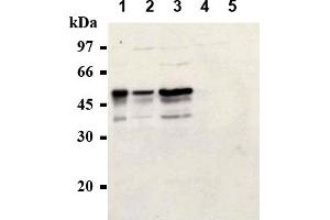 Western Blotting (WB) image for anti-Cyclin E1 (CCNE1) antibody (ABIN567783) (Cyclin E1 anticorps)