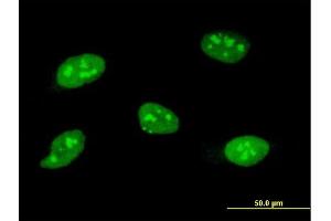 Immunofluorescence of monoclonal antibody to SOCS3 on HeLa cell. (SOCS3 anticorps  (AA 1-225))