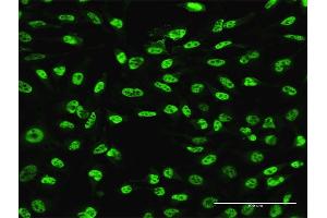 Immunofluorescence of monoclonal antibody to PLAG1 on HeLa cell.