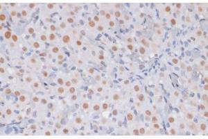 Immunohistochemistry of paraffin-embedded Rat ovary using TriMethyl-Histone H3-K27 Polyclonal Antibody at dilution of 1:100 (40x lens).