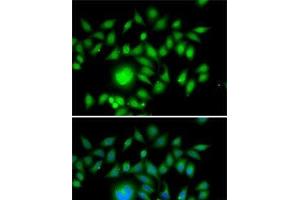 Immunofluorescence analysis of MCF7 cells using ATOH1 Polyclonal Antibody (ATOH1 anticorps)