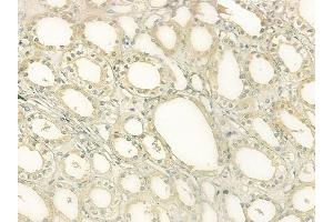 ABIN6265131 and ABIN6277621 at 1/100 staining human normal kidney tissue by IHC-P. (SLC3A1 anticorps  (C-Term))