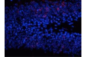 Immunostaining of granule cells in the dentate gyrus of saline treated mouse showing (MAPK1/2 (pThr202), (pTyr204) anticorps)