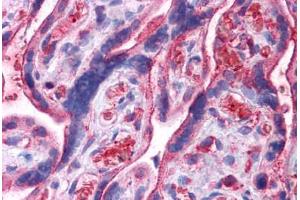 anti-Ubiquitin Carboxyl-terminal Esterase L3 (Ubiquitin Thiolesterase) (Uchl3) (N-Term) antibody