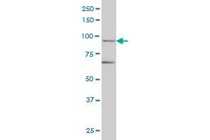 TRIM36 monoclonal antibody (M01), clone 2D11 Western Blot analysis of TRIM36 expression in IMR-32 .