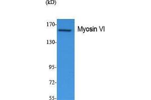 Western Blotting (WB) image for anti-Myosin VI (MYO6) (N-Term) antibody (ABIN3187633) (Myosin VI anticorps  (N-Term))