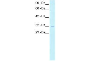 WB Suggested Anti-SIRT5 Antibody Titration:  1. (SIRT5 anticorps  (Middle Region))