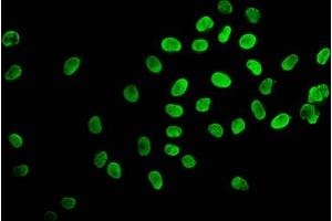 Immunofluorescence staining of Hela cells (treated with 30mM sodium butyrate for 4h) with ABIN7139155 at 1:2.