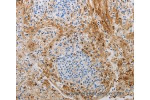 Immunohistochemistry of Human tonsil using NGFR Polyclonal Antibody at dilution of 1:50 (NGFR anticorps)