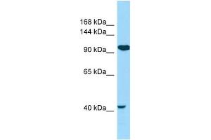 WB Suggested Anti-CILP2 Antibody Titration: 1. (Cilp2 anticorps  (N-Term))