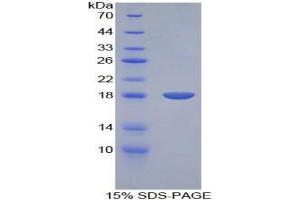 SDS-PAGE analysis of Rat BMP15 Protein. (BMP15 Protéine)