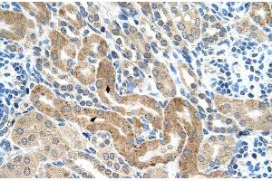 Human kidney (CHAF1B anticorps  (C-Term))