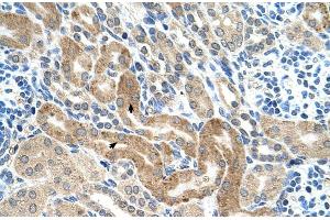 Human kidney (CHAF1B anticorps  (C-Term))