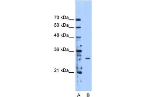 WB Suggested Anti-METTL1 Antibody Titration:  2. (METTL1 anticorps  (Middle Region))