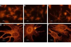 Expression of CNGA2 in rat cerebellum primary culture  - Immunocytochemical staining of paraformaldehyde-fixed and permeabilized rat cerebellum primary culture. (CNGA2 anticorps  (Intracellular))