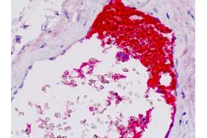 Anti-Complement C4c antibody IHC staining of human vessel.