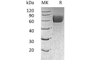 Western Blotting (WB) image for Interleukin 13 Receptor, alpha 1 (IL13RA1) protein (His tag,AVI tag) (ABIN7320865)