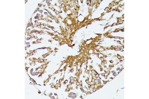 Immunohistochemistry of paraffin-embedded rat testis using HSP70/HSP antibody (2948) at dilution of 1:100 (40x lens).