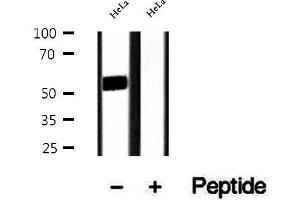 Western blot analysis of extracts of HeLa cells, using DMAP1 antibody. (DMAP1 anticorps  (Internal Region))