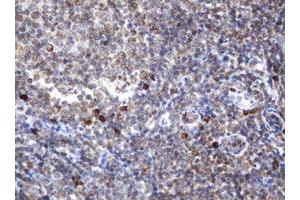 Image no. 2 for anti-Signal Recognition Particle Receptor, B Subunit (SRPRB) antibody (ABIN1501128) (SRPRB anticorps)