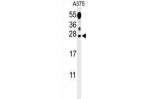 Western Blotting (WB) image for anti-Inosine Triphosphatase (ITPA) antibody (ABIN3002176) (ITPA anticorps)
