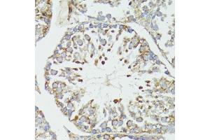 Immunohistochemistry of paraffin-embedded mouse testis using HSP70/HSP antibody (2948) at dilution of 1:100 (40x lens).