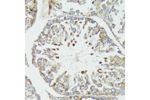 Immunohistochemistry of paraffin-embedded mouse testis using HSP70/HSP antibody (2948) at dilution of 1:100 (40x lens). (HSP70 1A anticorps  (AA 500-600))