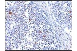 Immunohistochemistry of MDA5 in human lymph node tissue with MDA5 antibody at 5 μg/ml.