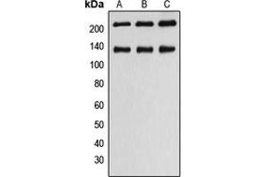 Western blot analysis of MLCK1 expression in HeLa (A), SP2/0 (B), H9C2 (C) whole cell lysates. (MYLK anticorps  (Center))