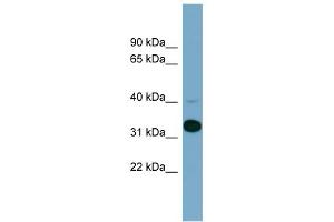 WB Suggested Anti-METAP1 Antibody Titration: 0.
