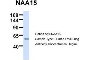 Host:  Rabbit  Target Name:  NAA15  Sample Type:  Human Fetal Lung  Antibody Dilution:  1. (NAA15 anticorps  (N-Term))