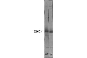 Western blot of bovine cerebellum homogenate stained with ABIN1580472 in lane 11. (VSNL1 anticorps)