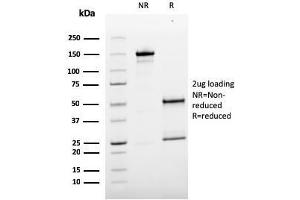 SDS-PAGE Analysis Purified MCAM Mouse Monoclonal Antibody (MCAM/3179). (MCAM anticorps)