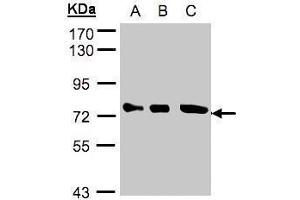 WB Image Sample(30 ug whole cell lysate) A:A431, B:H1299 C:Hep G2 , 10% SDS PAGE antibody diluted at 1:2000 (OPTN anticorps)