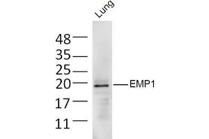 Mouse lung lysates probed with EMP1 Polyclonal Antibody, Unconjugated  at 1:300 dilution and 4˚C overnight incubation. (EMP1 anticorps  (AA 101-160))