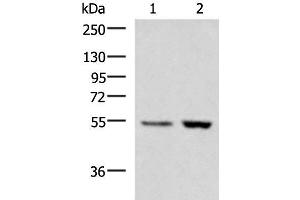 Western blot analysis of Human placenta tissue LOVO cell lysates using ZSWIM1 Polyclonal Antibody at dilution of 1:550 (ZSWIM1 anticorps)