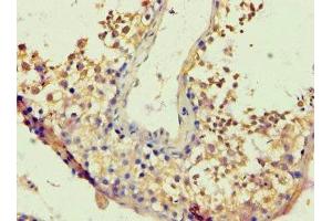 Immunohistochemistry of paraffin-embedded human testis tissue using ABIN7172717 at dilution of 1:100