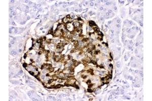 IHC testing of human pancreatic cancer tissue with GLP-1 antibody.