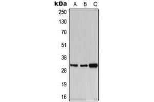 Western blot analysis of PBR expression in HEK293T (A), SP2/0 (B), PC12 (C) whole cell lysates.