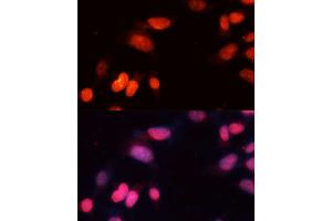 Immunofluorescence analysis of NIH-3T3 cells using SIRT1 Polyclonal Antibody (ABIN3020730, ABIN3020731, ABIN3020732, ABIN1513524 and ABIN6213695) at dilution of 1:100 (40x lens). (SIRT1 anticorps)