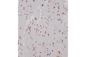 Immunohistochemical analysis of (ABIN1539554 and ABIN2849696) on paraffin-embedded human brain tissue was performed on the Leica®BOND RXm.