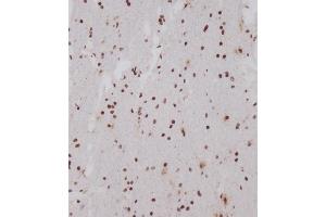 Immunohistochemical analysis of (ABIN1539554 and ABIN2849696) on paraffin-embedded human brain tissue was performed on the Leica®BOND RXm. (OTUD7A anticorps  (N-Term))