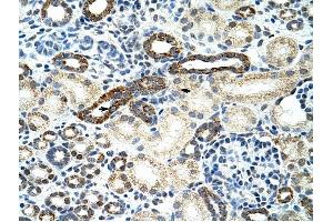 HNRPF antibody was used for immunohistochemistry at a concentration of 4-8 ug/ml to stain Epithelial cells of renal tubule (arrows! (HNRNPF anticorps  (C-Term))