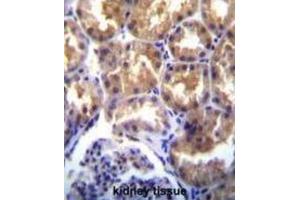 Immunohistochemistry (IHC) image for anti-Transient Receptor Potential Cation Channel, Subfamily M, Member 6 (TRPM6) antibody (ABIN3003652) (TRPM6 anticorps)