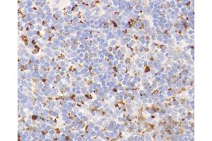 Immunohistochemistry analysis of parafffin-embedded mouse spleen using Lysozyme Polyclonal Antibody at dilution of 1:400. (LYZ anticorps)