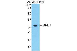 Western Blotting (WB) image for anti-Interleukin-1 Receptor-Associated Kinase 1 (IRAK1) (AA 212-440) antibody (ABIN1859466) (IRAK1 anticorps  (AA 212-440))
