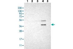 Western blot analysis of Lane 1: RT-4, Lane 2: U-251 MG, Lane 3: Human Plasma, Lane 4: Liver, Lane 5: Tonsil with WNT7A polyclonal antibody . (WNT7A anticorps)
