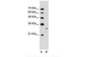 Image no. 2 for anti-MAP3K7 C-Terminal Like (MAP3K7CL) (AA 151-200) antibody (ABIN203427) (MAP3K7CL anticorps  (AA 151-200))