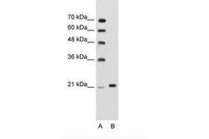 Image no. 1 for anti-Tripartite Motif Containing 26 (TRIM26) (AA 151-200) antibody (ABIN203509) (TRIM26 anticorps  (AA 151-200))